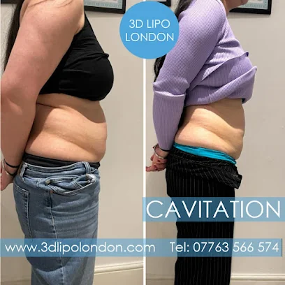 3D Lipo London Non surgical clinic logo
